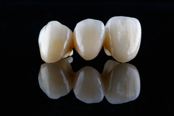 A Guide To   Types Of Dental Bridge