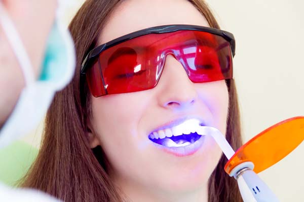 How A Dental Sealant Can Prevent Cavities