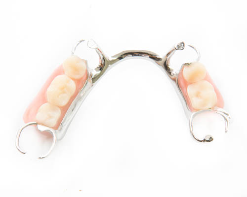 Pros And Cons Of Flexible Partial Dentures